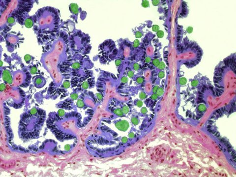 Coccidiosis, light micrograph