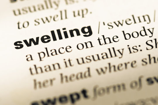 Could Your Swelling Be More Than Just Swelling - pop5fxw