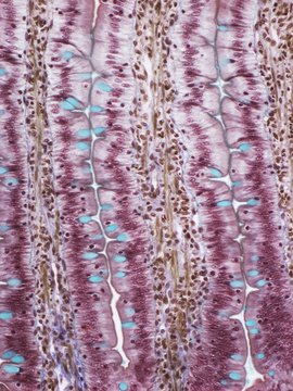 Small intestine, light micrograph
