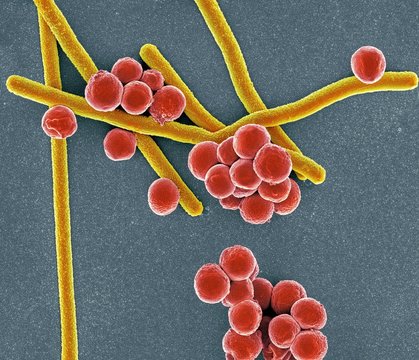 Rod-shaped and round bacteria, SEM