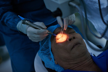 Close-up image of ophthalmologist ready to perform surgery - obrazy, fototapety, plakaty