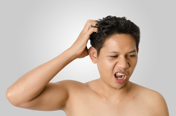 Man scratching his head as dandruff