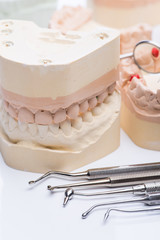 Teeth molds with basic dental tools on a bright white table