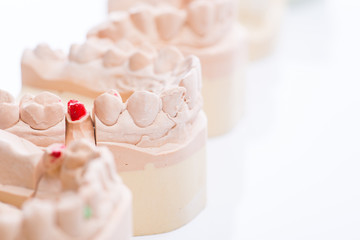 Teeth molds on a bright white table