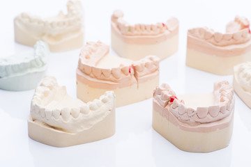 Teeth molds on a bright white table