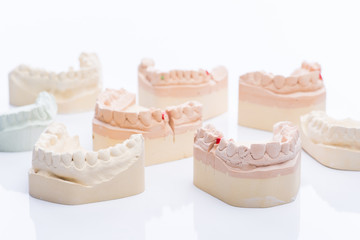 Teeth molds on a bright white table