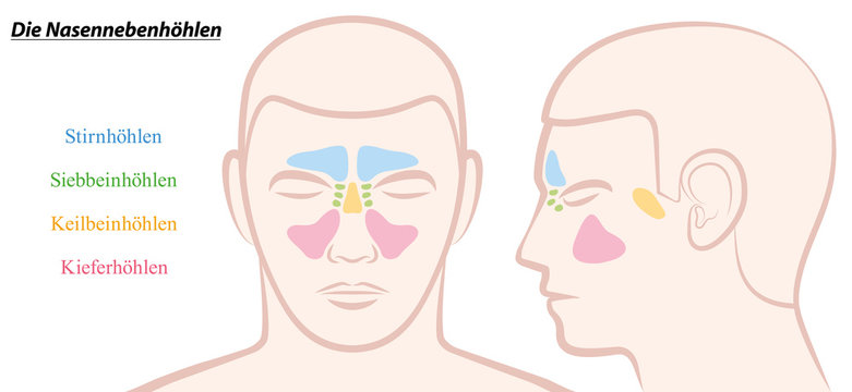Paranasal sinuses on a male face in different colors - GERMAN TEXT! Isolated vector illustration over white.