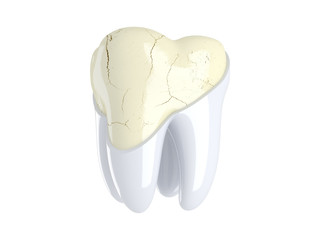 Cracks in the tooth. 3D render