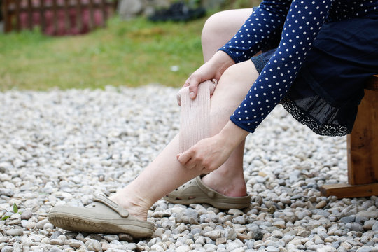 Woman with varicose veins applying compression bandage