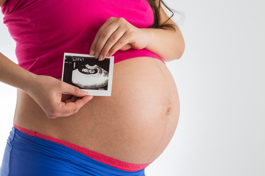 Pregnant woman holding ultrasound scan photo of her baby isolate