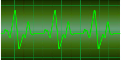 Starke Herzfrequenz gr&uuml;n Sinus Linie durchgehend