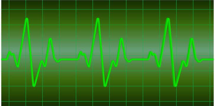 Starke Herzfrequenz gr&uuml;n Sinus Linie durchgehend