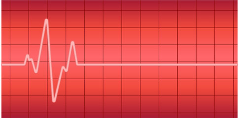 Herzstillstand rote Nulllinie - Herzversagen