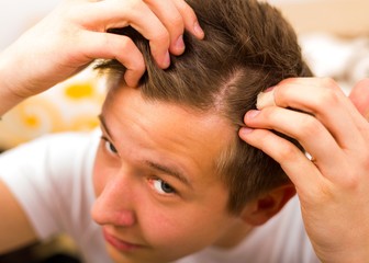 Hair loss comes even in youth