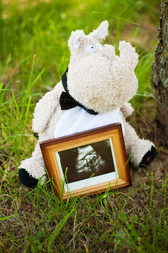 View of  baby ultrasound scan