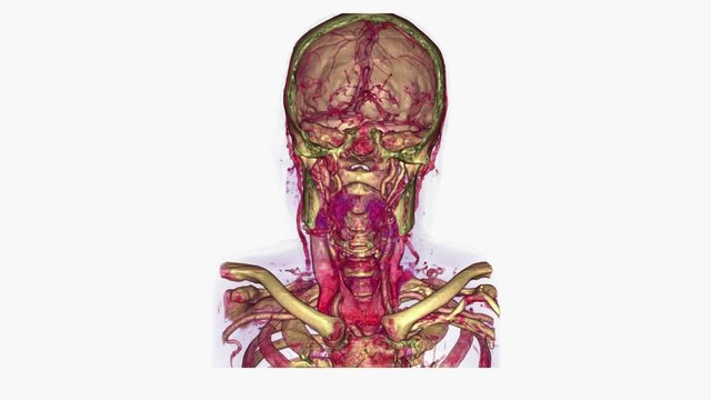 Skull of elderly man