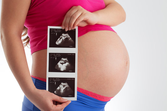Pregnant woman holding ultrasound scan photo of her baby isolate