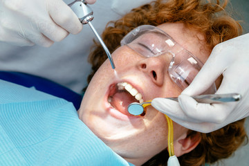 The doctor inspects the child teeth