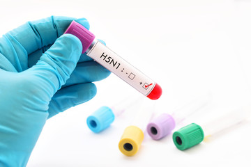 H5N1 influenza virus positive