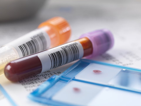 Blood and urine samples with medical results