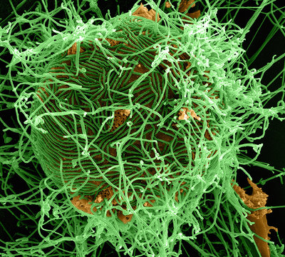 Filamentous Ebola Virus Particles (colored Green) Budding From A Chronically-infected VERO E6 Cell (colored Yellow)