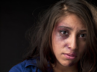 portrait of a abused woman.