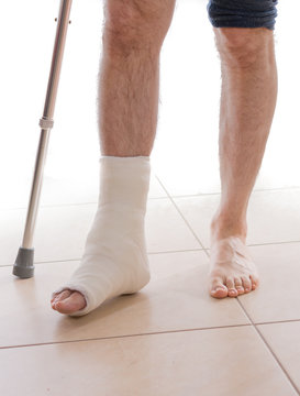 Young man with a broken ankle and a leg cast