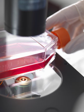 Flask containing cultures sitting on platform of inverted microscope in lab