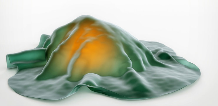 3D illustration of a highly invasive tumor cell