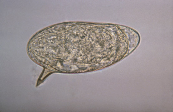 Schistosoma mansoni egg showing lateral spine. Schistosomiasis (also known as bilharzia, snail fever, and Katayama fever) is a disease caused by parasitic worms of the Schistosoma type