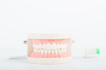 Dental implant model