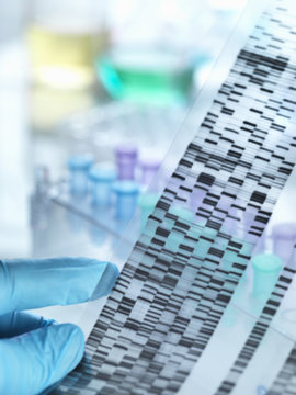 Scientist holding DNA gel in front of samples for testing in laboratory