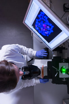 Cancer research laboratory,  overhead view of female scientist studying cancer cells under electronic microscope
