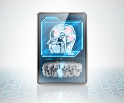Tablet with scan of cerebral activity on futuristic background