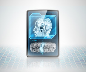 Tablet with cerebral scan on futuristic background
