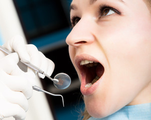 The reception was at the female dentist. Doctor examines the oral cavity on tooth decay. Caries...