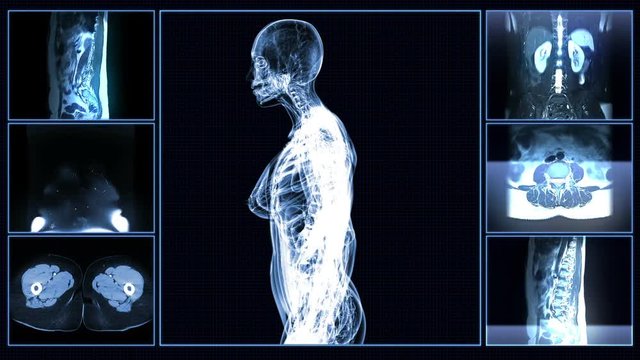 All female body systems MRI scan
