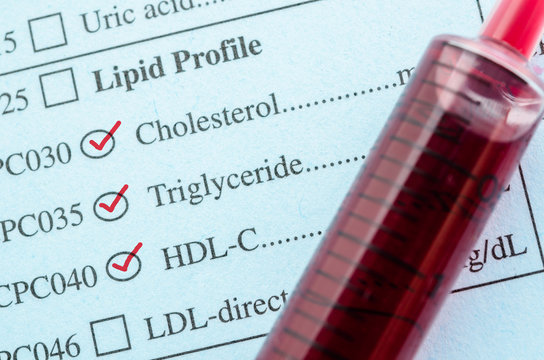 Red mark check on Cholesterol, Triglyceride and HDL-Con request