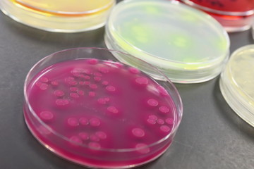 研究イメージ　細菌　大腸菌