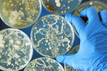 Gloved hand holding bacteria growing in a petri dishes