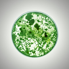Bacteria growing in a petri dish