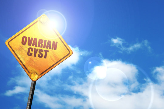 ovarian cyst, 3D rendering, a yellow road sign
