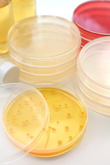 研究イメージ　微生物の鑑別