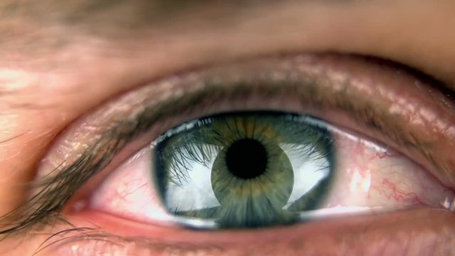 Super 35mm camera - Closeup of an blue/green watery eye
