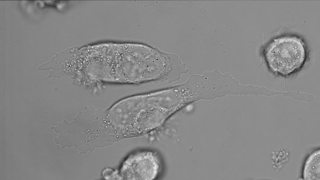PC-3 human prostate cancer cell in culture, microfilaments were disrupted by cytochalasin D
