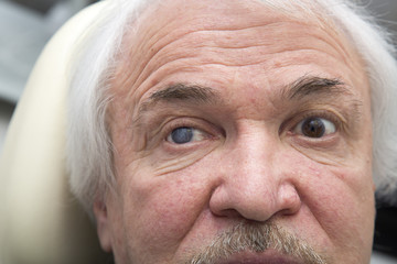 Portrait of elderly man with eye disease