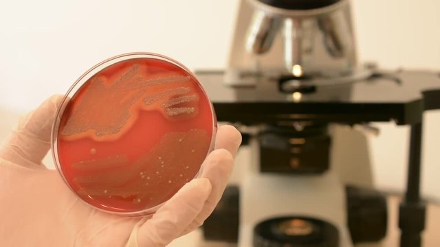 Scientist's hand checking petri dish and pointing streptococcus bacteria with inoculation loop