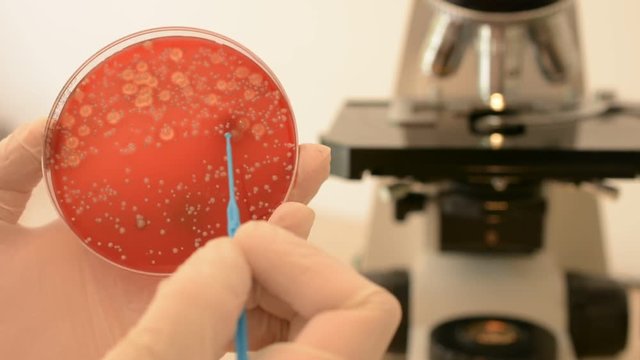 Scientist's hand checking petri dish and pointing Escherichia coli bacteria with inoculation loop