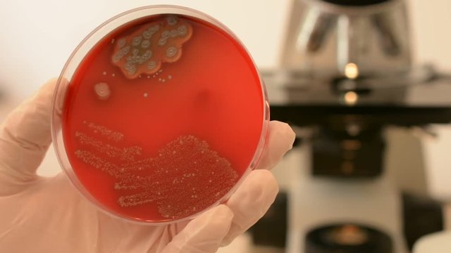 Scientist's hand checking petri dish and pointing bacteria with inoculation loop