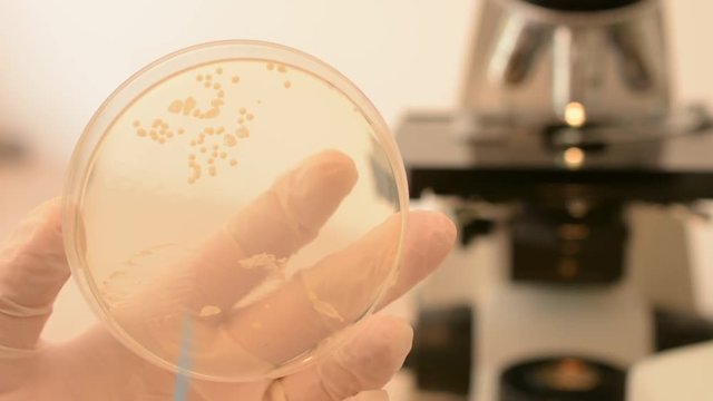 Scientist's hand checking petri dish and pointing fungus with inoculation loop. Candida albicans fungus on petri dish